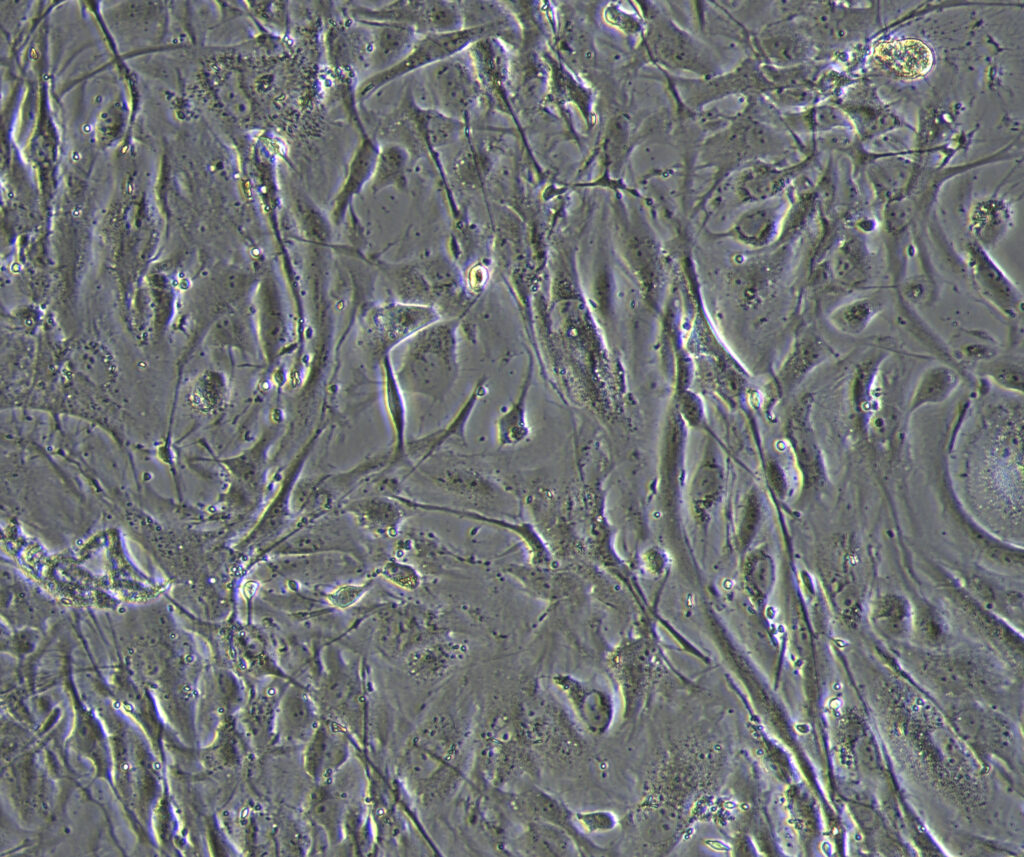 Cell population derived from leg pieces of Bombina variegata (Yellow-bellied toad). One could notice a mix of morphologically different cells that are, inter-alia, muscular syncytium, fibroblast and epithelial-like cells.