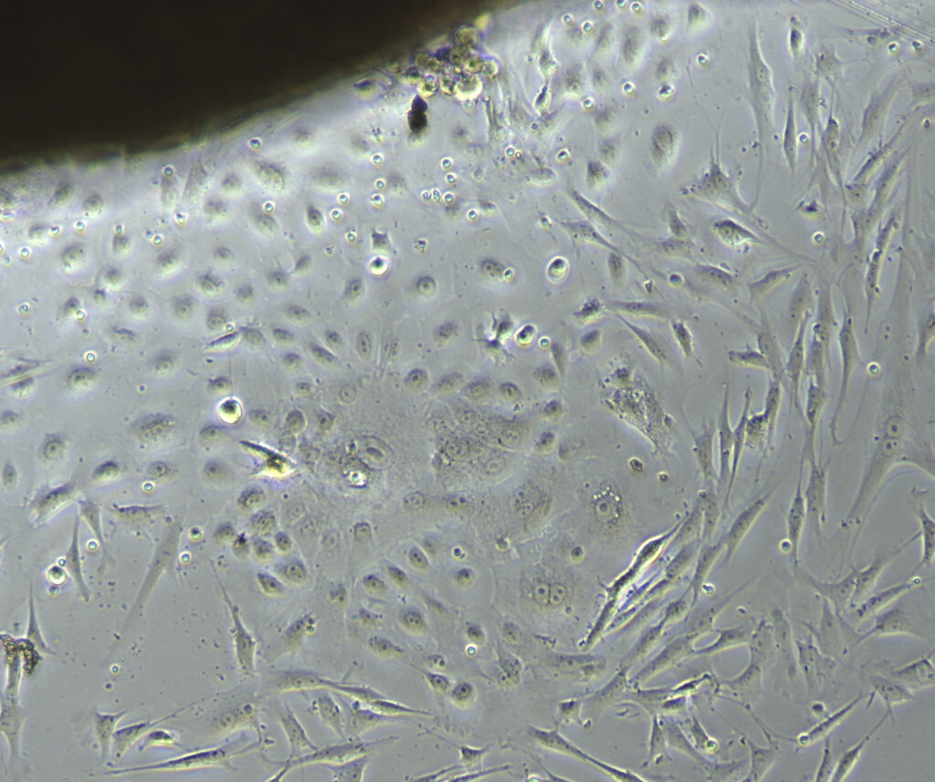 Heterogeneous cell population growing from an explant of lip (structure on the top in the image) collected from a Panthera tigris (Tiger). Epithelial-like cells are growing close to the tissue, while fibroblast-like cells are migrating away in the outer layer.